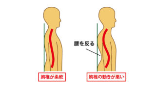腰を反る痛み