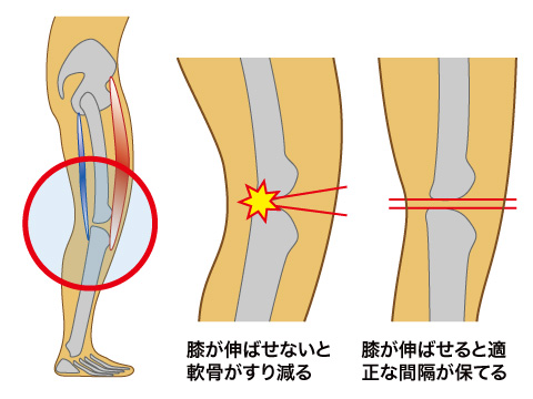 膝